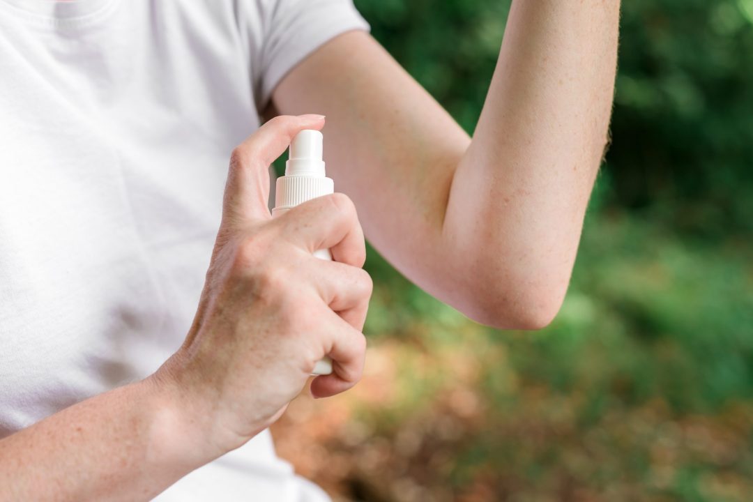 First Aid - Burns: Treating Minor Burns