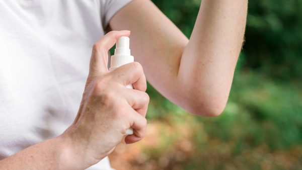 First Aid - Burns: Treating Minor Burns
