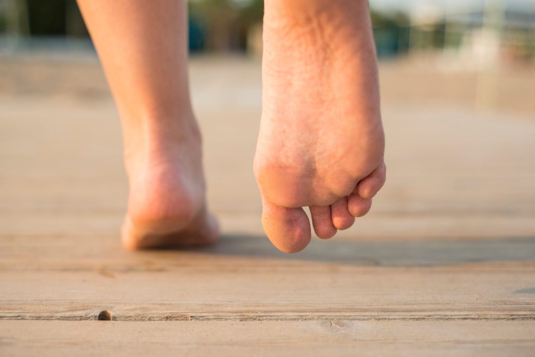 Suggesting Shoes Based on Pronation and Arch Type: Types of Arches and Shoes That Fit Them Best