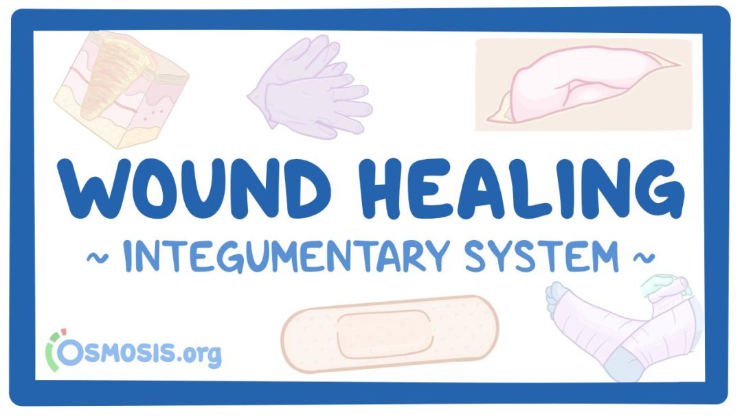 Integumentary System: Wound Healing