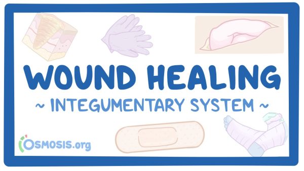 Integumentary System: Wound Healing