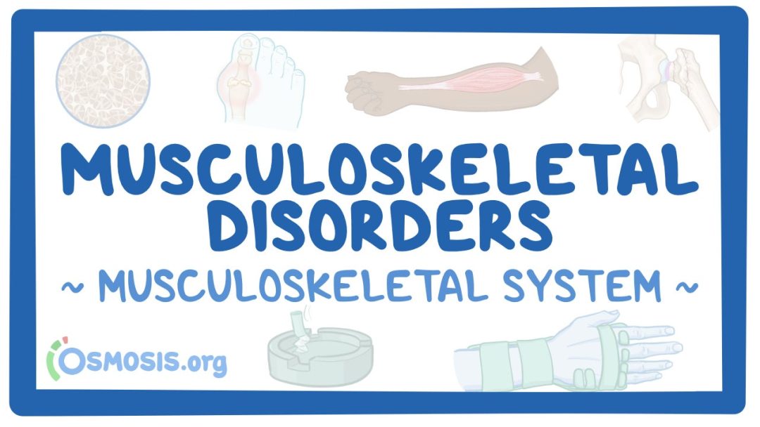 Musculoskeletal System: Musculoskeletal Disorders