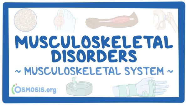 Musculoskeletal System: Musculoskeletal Disorders
