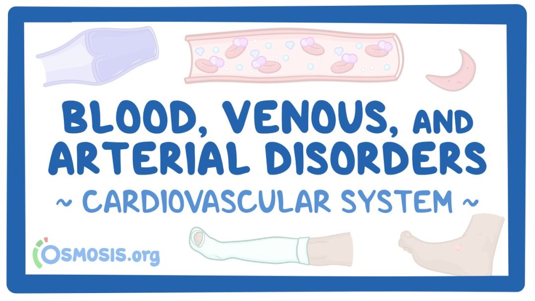 Cardiovascular System: Blood, Venous, And Arterial Disorders