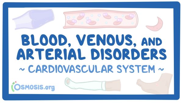 Cardiovascular System: Blood, Venous, And Arterial Disorders