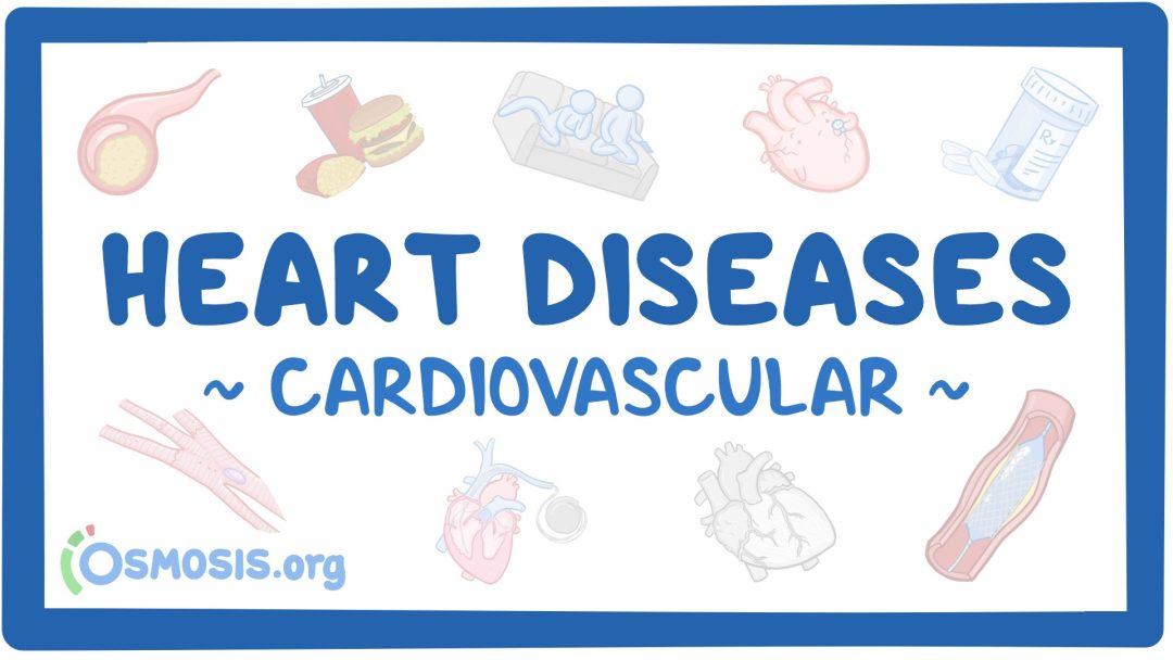 Cardiovascular System: Heart Diseases