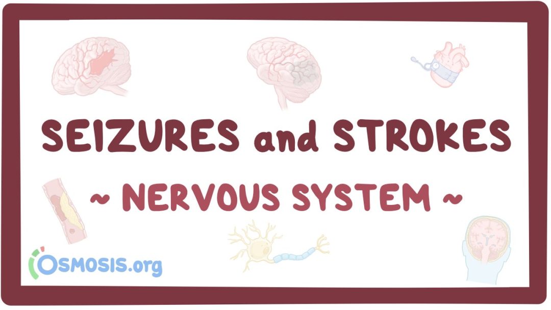 Nervous System: Seizure And Strokes