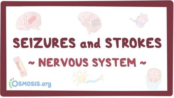 Nervous System: Seizure And Strokes