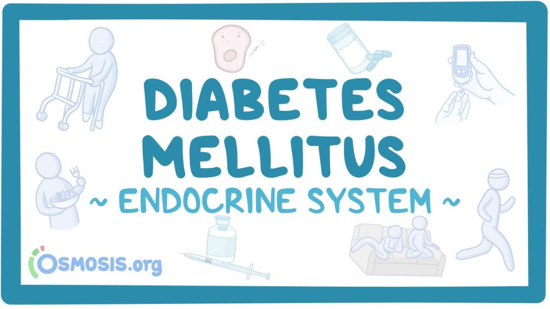 Endocrine System: Diabetes Mellitus
