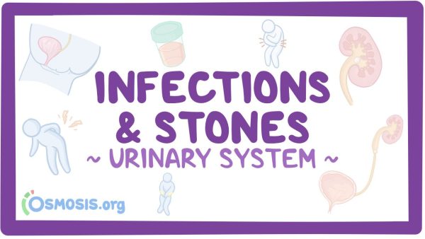 Urinary System: Infections And Stones