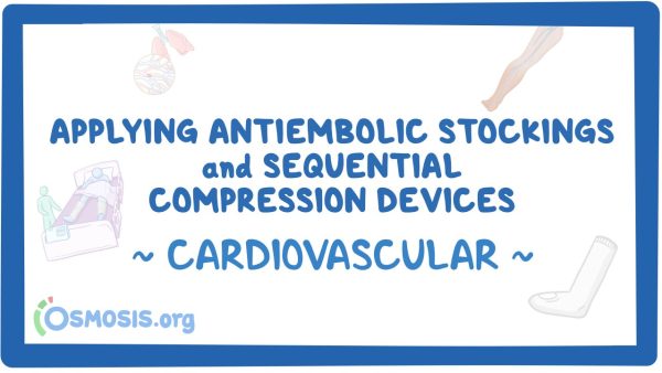 Cardiovascular: Applying Antiembolic Stockings And Sequential Compression Devices