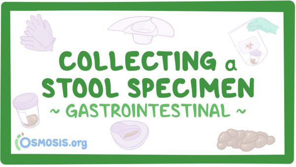 Gastrointestinal: Collecting A Stool Specimen