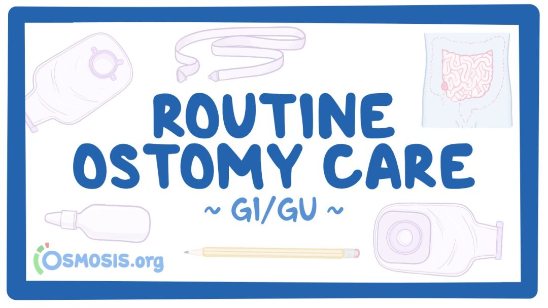 Gastrointestinal: Routine Ostomy Care