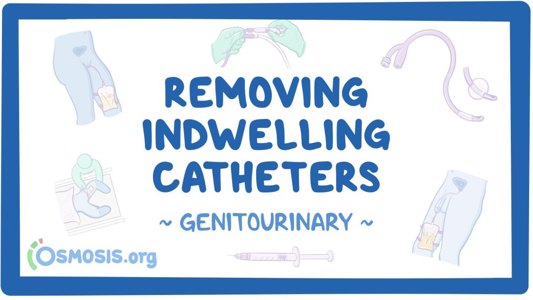 Genitourinary: Removing Indwelling Catheters