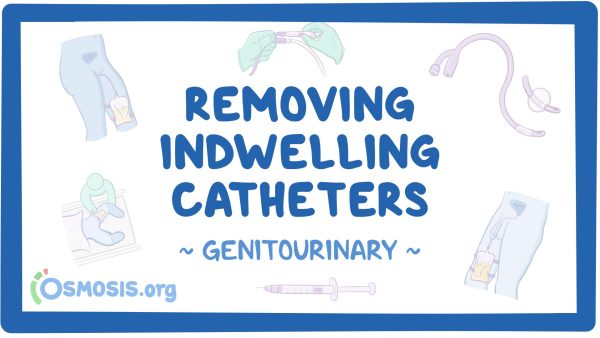 Genitourinary: Removing Indwelling Catheters