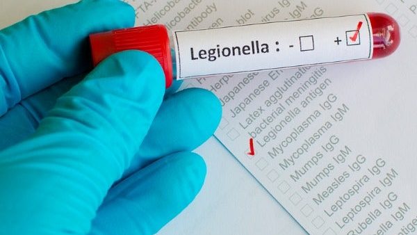 Legionella and Water Management