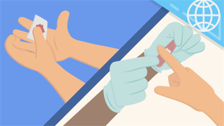 First Aid: Bleeding