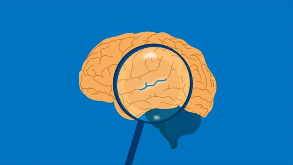 How Does Unconscious Bias Happen?