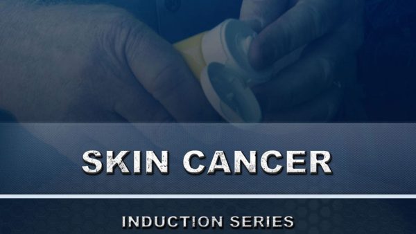 Skin Cancer