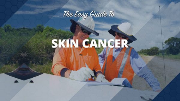 The Easy Guide to Skin Cancer
