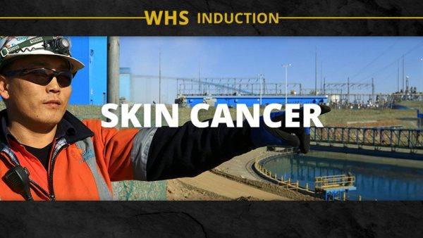 WHS Induction: Skin Cancer