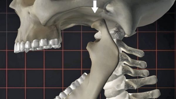 The How to Sing Series: Releasing Jaw Tension