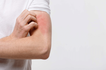Lyme is Ticking: Updates on the Management of Lyme Disease and Other Tick-Borne Infections